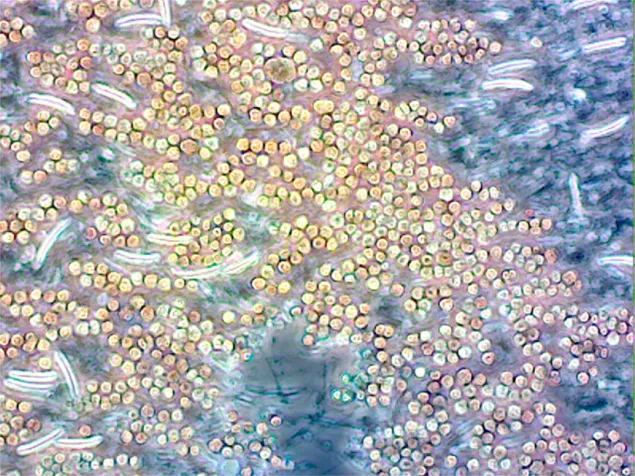 Nematocysts and Symbiodinium that have spilled out from a cut tentacle of Aiptasia pallida