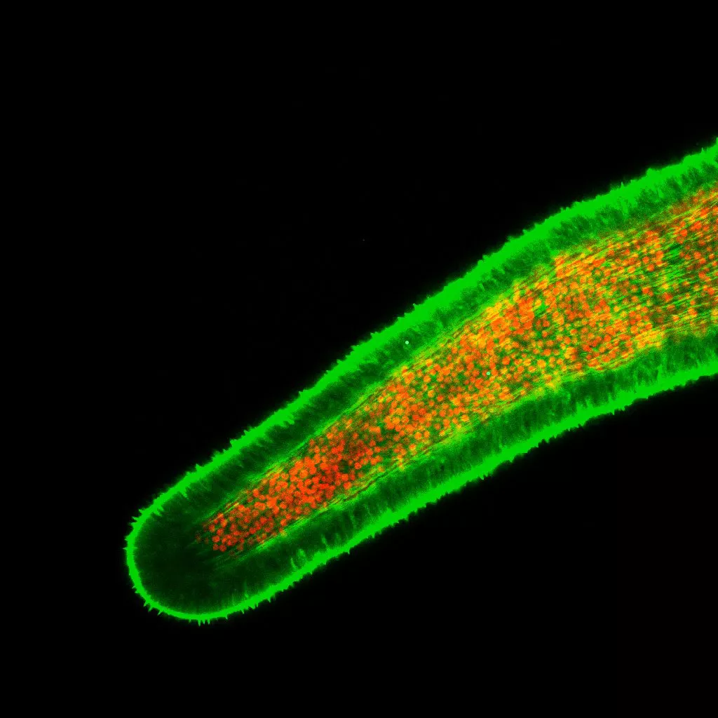 A photomicrograph of a single Aiptasia tentacle