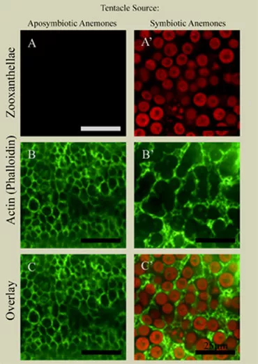 actin cytoskeleton